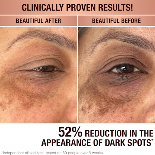 DARK SPOT CORRECTING RADIANCE RECOVERY SERummer 30 ML