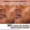 DARK SPOT CORRECTING RADIANCE RECOVERY SERummer 30 ML