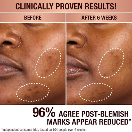DARK SPOT CORRECTING RADIANCE RECOVERY SERummer 30 ML
