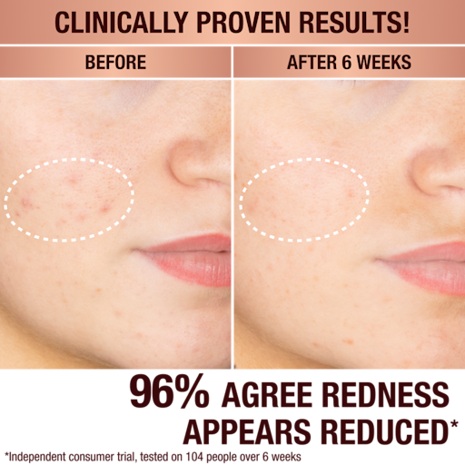 DARK SPOT CORRECTING RADIANCE RECOVERY SERummer 30 ML
